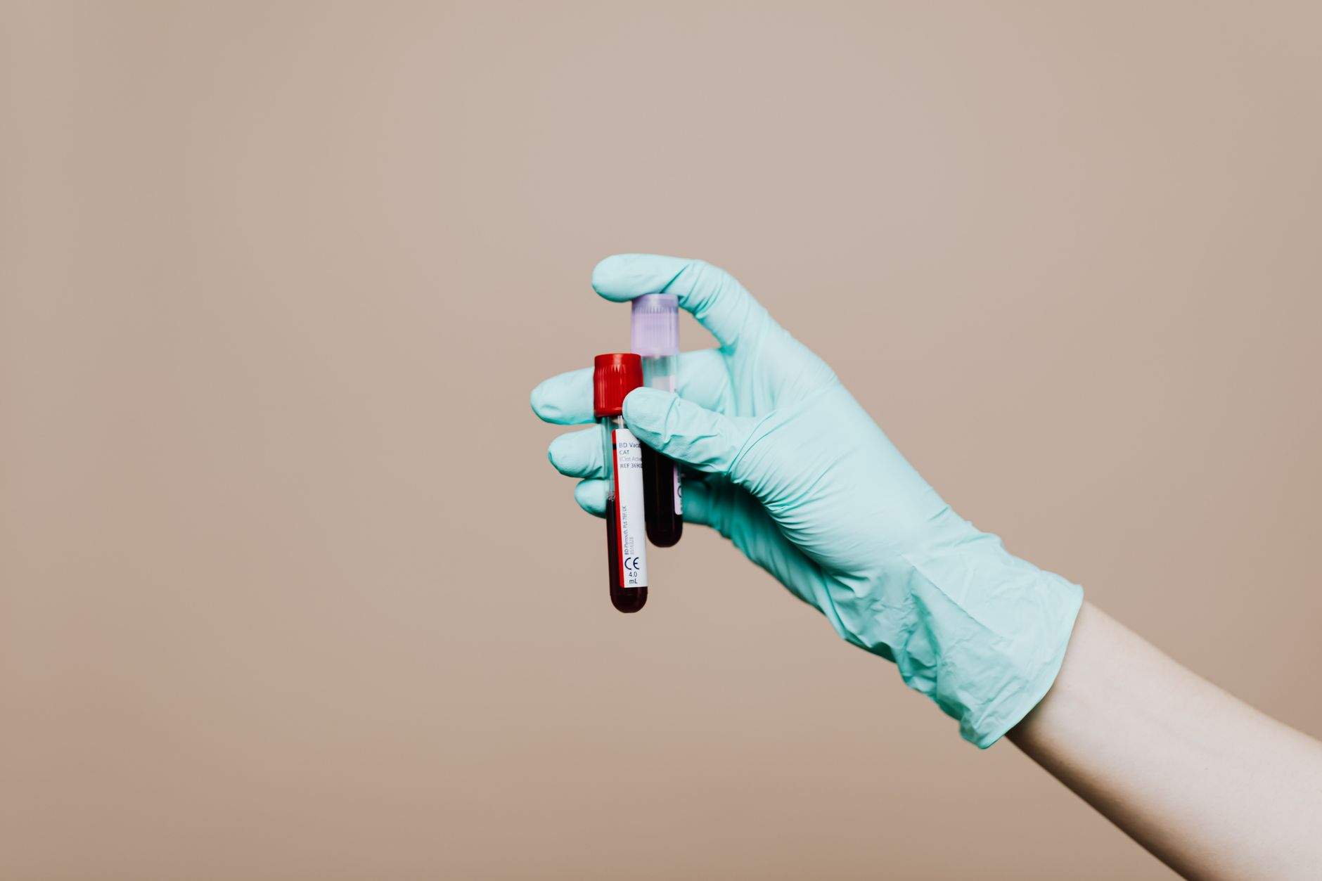 Vitamin K2 Wechselwirkungen: Medikamente und Nährstoffe